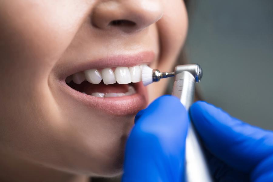 Cracked and Chipped Teeth: Why Prompt Dental Evaluation Is Critical